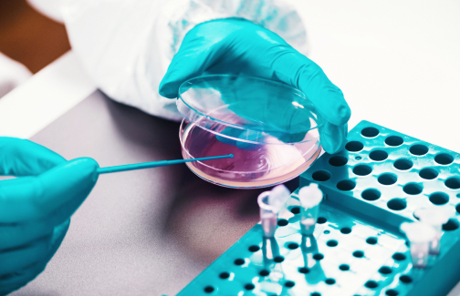 Laboratoire Alliance Anabio Laboratoire D Analyse Rennes Microbiologie